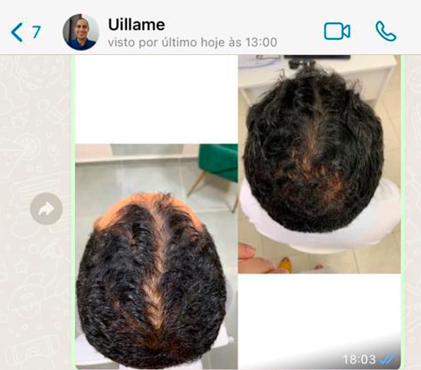 Uillame01