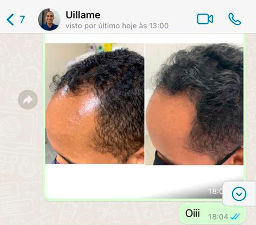 Uillame02