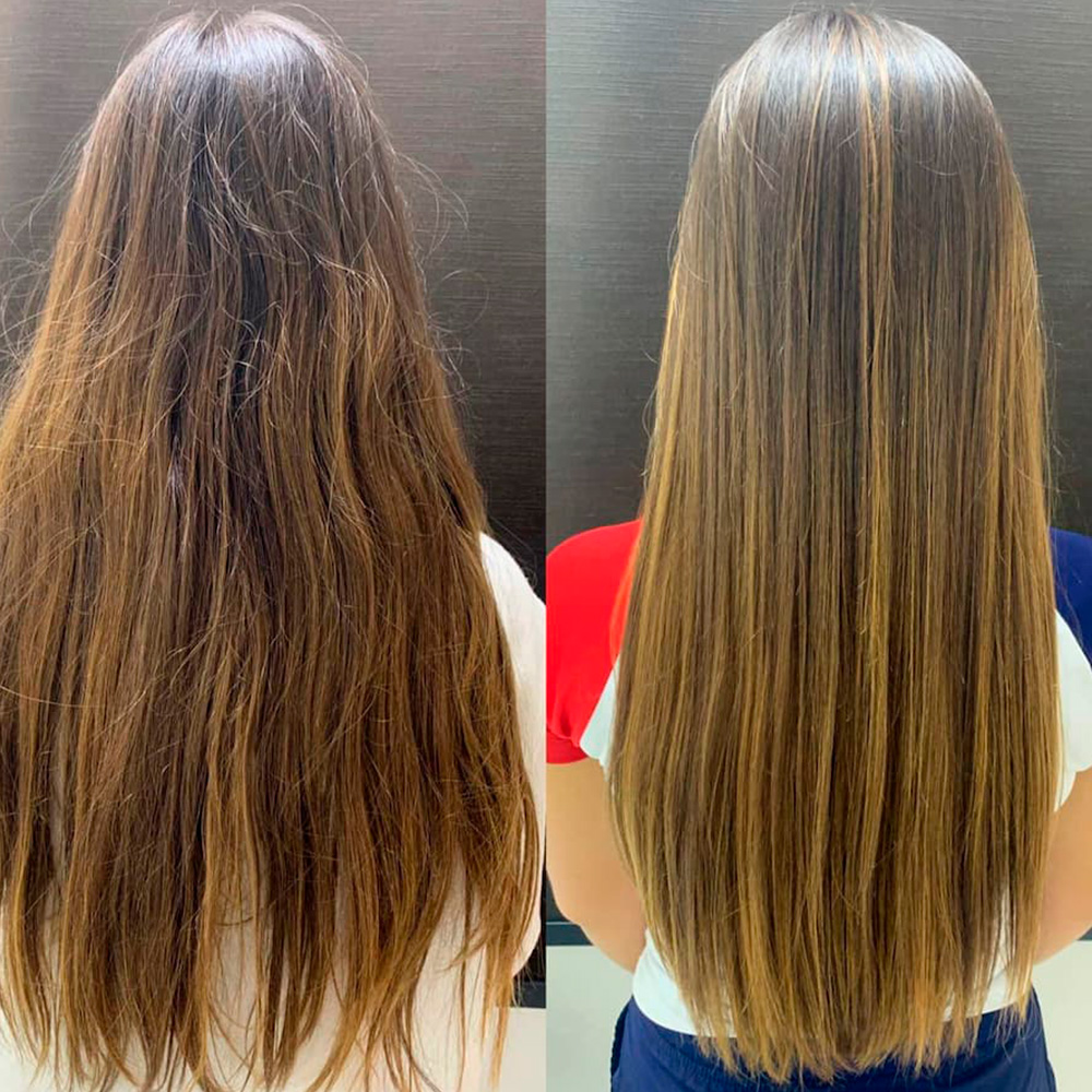 antes-e-dps-4